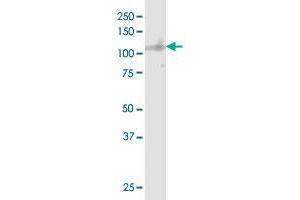 SORT1 monoclonal antibody (M01), clone 1B3.