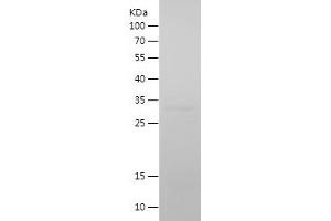 Western Blotting (WB) image for Cadherin 13 (CDH13) (AA 139-381) protein (His tag) (ABIN7122071)