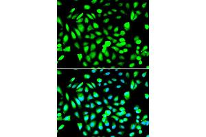 Immunofluorescence analysis of A549 cell using PRMT5 antibody. (PRMT5 anticorps)