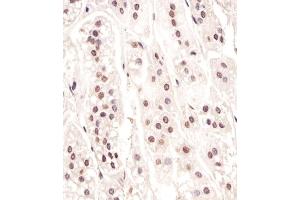 C staining CDC73 in human adrenal gland tissue sections by Immunohistochemistry (IHC-P - paraformaldehyde-fixed, paraffin-embedded sections).