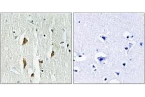Immunohistochemistry analysis of paraffin-embedded human brain tissue, using PAK1/2/3 (Ab-423/402/421) Antibody. (PAK1/2/3 anticorps  (AA 391-440))