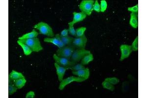 Immunofluorescence staining of HepG2 cells with ABIN7140126 at 1:168, counter-stained with DAPI.