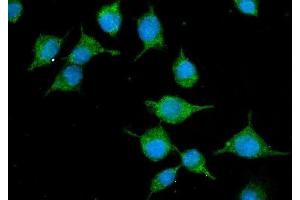 IF analysis of SLC10A1/NTCP1 using anti-SLC10A1/NTCP1 antibody (ABIN7601234).