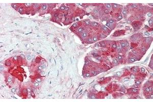 Detection of CPB1 in Human Pancreas Tissue using Polyclonal Antibody to Carboxypeptidase B1, Tissue (CPB1) (CPB1 anticorps  (AA 111-417))