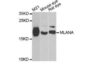 Western blot analysis of extracts of various cell lines, using MLANA antibody. (MLANA anticorps  (AA 48-118))