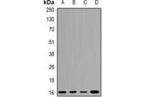 Western blot analysis of UBCH7 expression in A549 (A), K562 (B), mouse testis (C), mouse brain (D) whole cell lysates. (UBE2L3 anticorps)