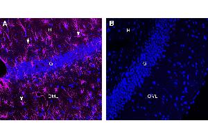 Comparison of immunostaining with Anti-GFAP antibody to immunostaining with isotype control in rat hippocampusImmunohistochemical staining of perfusion-fixed frozen rat brain sections with Anti-GFAP-ATTO Fluor-647N Antibody (ABIN7582030), (1:80). (Lapin IgG isotype control (Atto 647N))