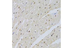 Immunohistochemistry of paraffin-embedded rat heart using SNRPA Antibody (ABIN5973811) at dilution of 1/100 (40x lens). (SNRPA1 anticorps)