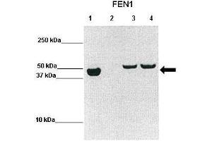 WB Suggested Anti-FEN1 Antibody  Positive Control: Lane1: hFEN1 (1-336), Lane2: uninduced BL21, Lane3: 2h induced BL21, Lane4: overnight induced BL21  Primary Antibody Dilution :  1:2000 Secondary Antibody :  Goat anti-rabbit-HRP Secondry Antibody Dilution :  1:10,000 Submitted by: Prof. (FEN1 anticorps  (N-Term))
