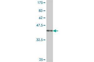 Western Blot detection against Immunogen (38. (GRK4 anticorps  (AA 36-145))
