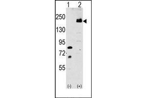 Image no. 1 for anti-Low Density Lipoprotein Receptor-Related Protein 6 (LRP6) (C-Term) antibody (ABIN358636) (LRP6 anticorps  (C-Term))