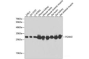 Western blot analysis of extracts of various cell lines using PGAM2 Polyclonal Antibody at dilution of 1:1000. (PGAM2 anticorps)