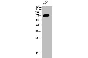 Western Blot analysis of 293T cells using PP2A-B56-δ Polyclonal Antibody (PPP2R5D anticorps  (C-Term))
