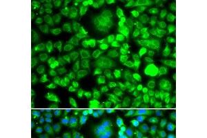 Immunofluorescence analysis of MCF-7 cells using BLID Polyclonal Antibody (BLID anticorps)