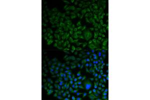 Immunofluorescence (IF) image for anti-Farnesyl-Diphosphate Farnesyltransferase 1 (FDFT1) antibody (ABIN1882356) (FDFT1 anticorps)