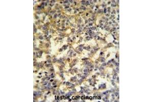 Immunohistochemistry (IHC) image for anti-Glucose-6-Phosphate Dehydrogenase (G6PD) antibody (ABIN3002234) (Glucose-6-Phosphate Dehydrogenase anticorps)