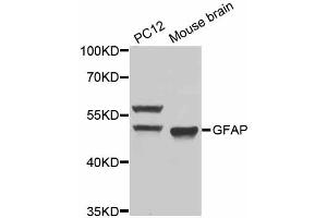 Western blot analysis of extracts of various cell lines, using GFAP antibody (ABIN5970067) at 1/1000 dilution. (GFAP anticorps)