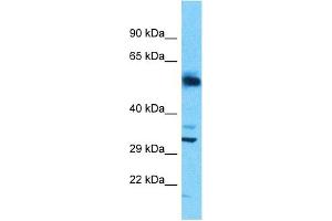 Host:  Rabbit  Target Name:  SLC25A30  Sample Type:  Uterus Tumor lysates  Antibody Dilution:  1. (SLC25A30 anticorps  (N-Term))