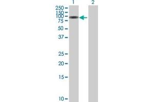 Western Blot analysis of SERPING1 expression in transfected 293T cell line by SERPING1 MaxPab polyclonal antibody.