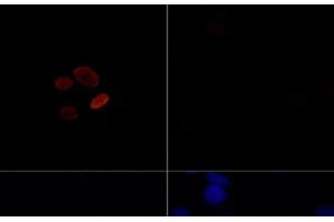 anti-Histone H4 (acLys16) antibody