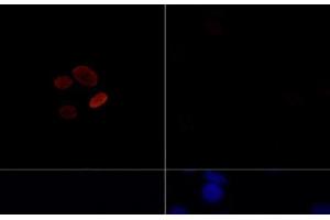 Immunofluorescence analysis of C6 cells treated by TSA (upper left) and untreated C6 cells (upper right) using Acetyl-Histone H4-K16 Polyclonal Antibody at dilution of 1:100. (Histone H4 anticorps  (acLys16))