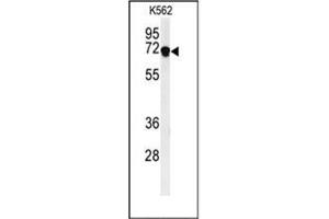 DENND1A anticorps  (C-Term)