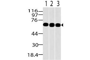 Image no. 1 for anti-Methyl-CpG Binding Domain Protein 1 (MBD1) (AA 291-586) antibody (ABIN5027347) (MBD1 anticorps  (AA 291-586))
