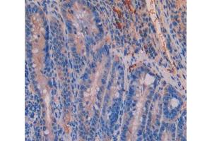 IHC-P analysis of Kidney tissue, with DAB staining. (UMPS anticorps  (AA 311-481))