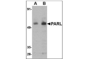 Western blot analysis of PARL in 3T3 cell lysate with PARL antibody at (A) 1 and (B) 2 µg/ml. (PARL anticorps  (N-Term))