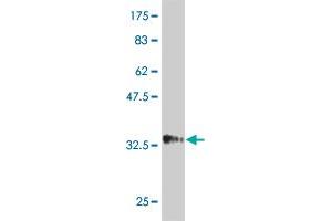 Western Blot detection against Immunogen (34. (HAND2 anticorps  (AA 135-216))
