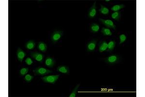 Immunofluorescence of monoclonal antibody to SMAD4 on HeLa cell.