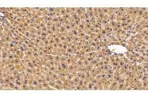 Detection of CAT in Mouse Liver Tissue using Polyclonal Antibody to Catalase (CAT) (Catalase anticorps  (AA 401-523))