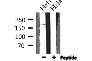 Western blot analysis of extracts from Hela, using BCOR Antibody. (BCOR anticorps  (Internal Region))