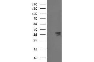 Western Blotting (WB) image for anti-Cyclin-Dependent Kinase 2 (CDK2) antibody (ABIN1497399) (CDK2 anticorps)