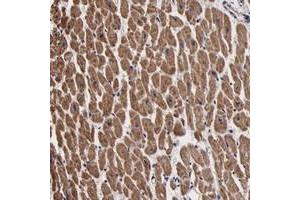 Immunohistochemical staining of human heart muscle with PSMA3 polyclonal antibody  shows moderate cytoplasmic positivity in myocytes.