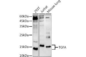Western blot analysis of extracts of various cell lines, using TGFA antibody (ABIN3020947, ABIN3020948, ABIN3020949, ABIN1513602 and ABIN6213813) at 1:500 dilution.