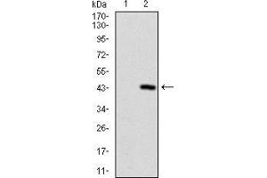 Western blot analysis using SQSTM1 mAb against HEK293 (1) and SQSTM1 (AA: 232-356)-hIgGFc transfected HEK293 (2) cell lysate.