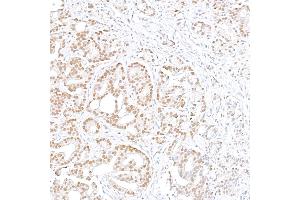 anti-Mediator Complex Subunit 12 (MED12) (C-Term) antibody