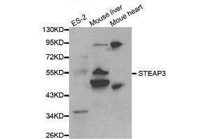Western blot analysis of extracts of various cell lines, using STEAP3 antibody. (STEAP3 anticorps)