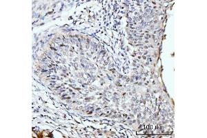 IHC analysis of SBNO1 using anti-SBNO1 antibody (ABIN7601710). (SBNO1 anticorps  (AA 43-1303))