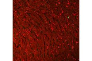 IF analysis of Histone H3 and GFAP using anti-Histone H3 antibody  and anti-GFAP antibody (ABIN7602675).