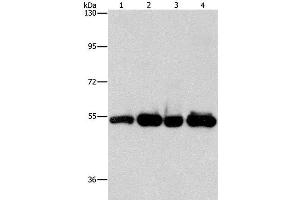 Western Blot analysis of Human bladder carcinoma tissue and A172 cell, Human fetal brain tissue and hela cell using PDE4D Polyclonal Antibody at dilution of 1:500 (PDE4D anticorps)