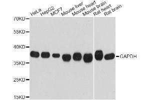 Western blot analysis of extracts of various cell lines, using GAPDH antibody. (GAPDH anticorps)