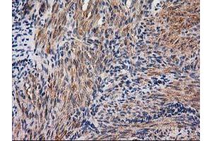 Immunohistochemical staining of paraffin-embedded Human endometrium tissue using anti-NNMT mouse monoclonal antibody. (NNMT anticorps)