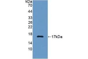 Detection of Recombinant C7, Rat using Polyclonal Antibody to Complement Component 7 (C7) (C7 anticorps  (AA 1-144))