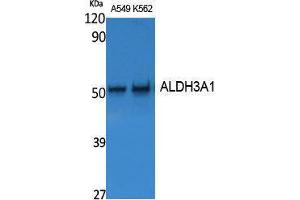 Western Blotting (WB) image for anti-Aldehyde Dehydrogenase 3 Family, Member A1 (ALDH3A1) (Internal Region) antibody (ABIN3187594)