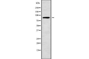 Western blot analysis NUP88 using COLO205 whole cell lysates (NUP88 anticorps  (Internal Region))