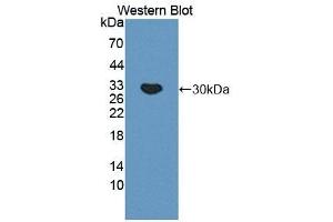 Detection of Recombinant C4BPa, Mouse using Polyclonal Antibody to C4 Binding Protein Alpha (C4BPa) (C4BPA anticorps  (AA 57-306))