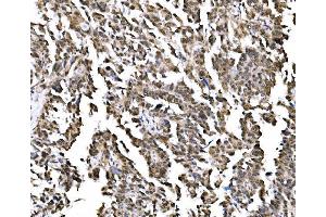 IHC analysis of NOLA1/GAR1 using anti-NOLA1/GAR1 antibody (ABIN7602076). (GAR1 anticorps  (AA 58-165))