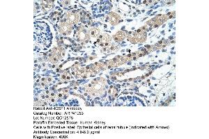 Rabbit Anti-IGSF1 Antibody  Paraffin Embedded Tissue: Human Kidney Cellular Data: Epithelial cells of renal tubule Antibody Concentration: 4. (IGSF1 anticorps  (N-Term))
